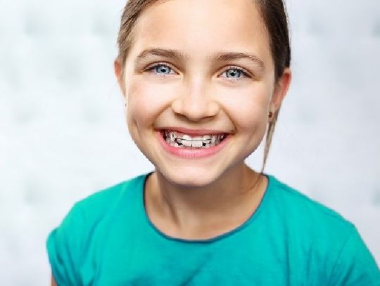 Ekspert radzi jak prawidłowo dbać o zęby z aparatem ortodontycznym