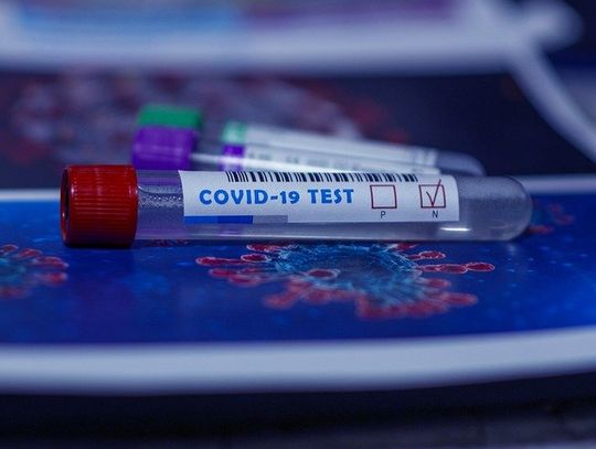 MZ: 15 362 nowe zakażenia koronawirusem, zmarły 674 osoby, najwięcej od początku epidemii