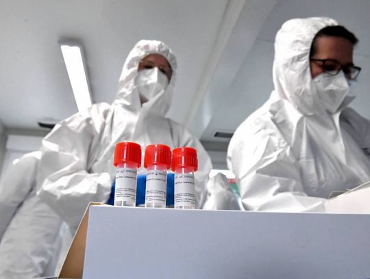 MZ: 34 151 nowych przypadków zakażenia koronawirusem - najwięcej od początku pandemii; zmarło 520 osób