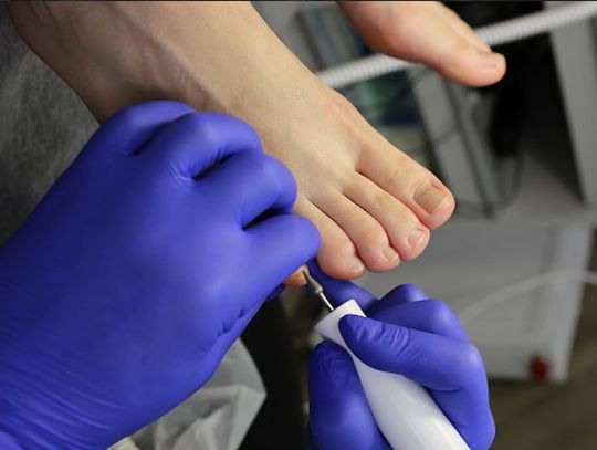 Na czym polega pedicure męski? Ile kosztuje?