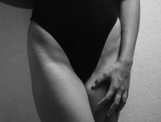 Skóra o zmniejszonej odporności na czynniki zewnętrzne