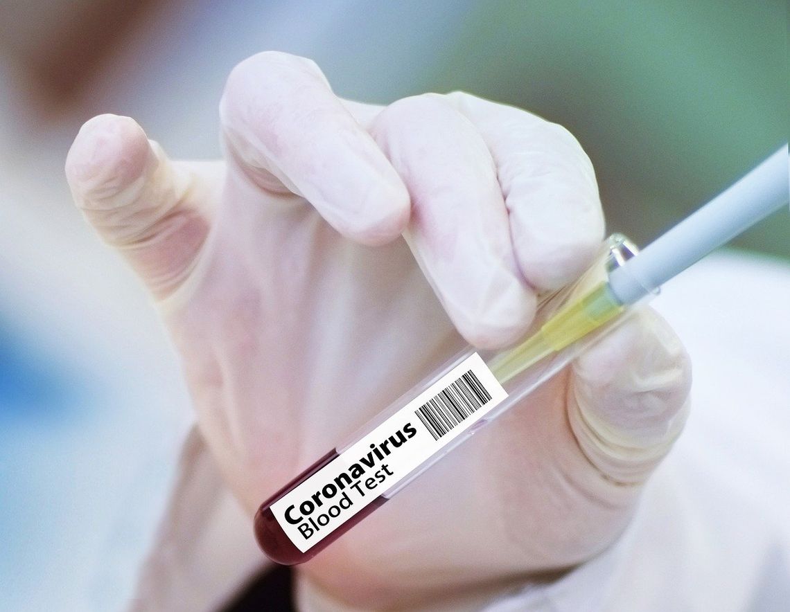Badanie: Część testów na obecność koronawirusa fałszywie pozytywna