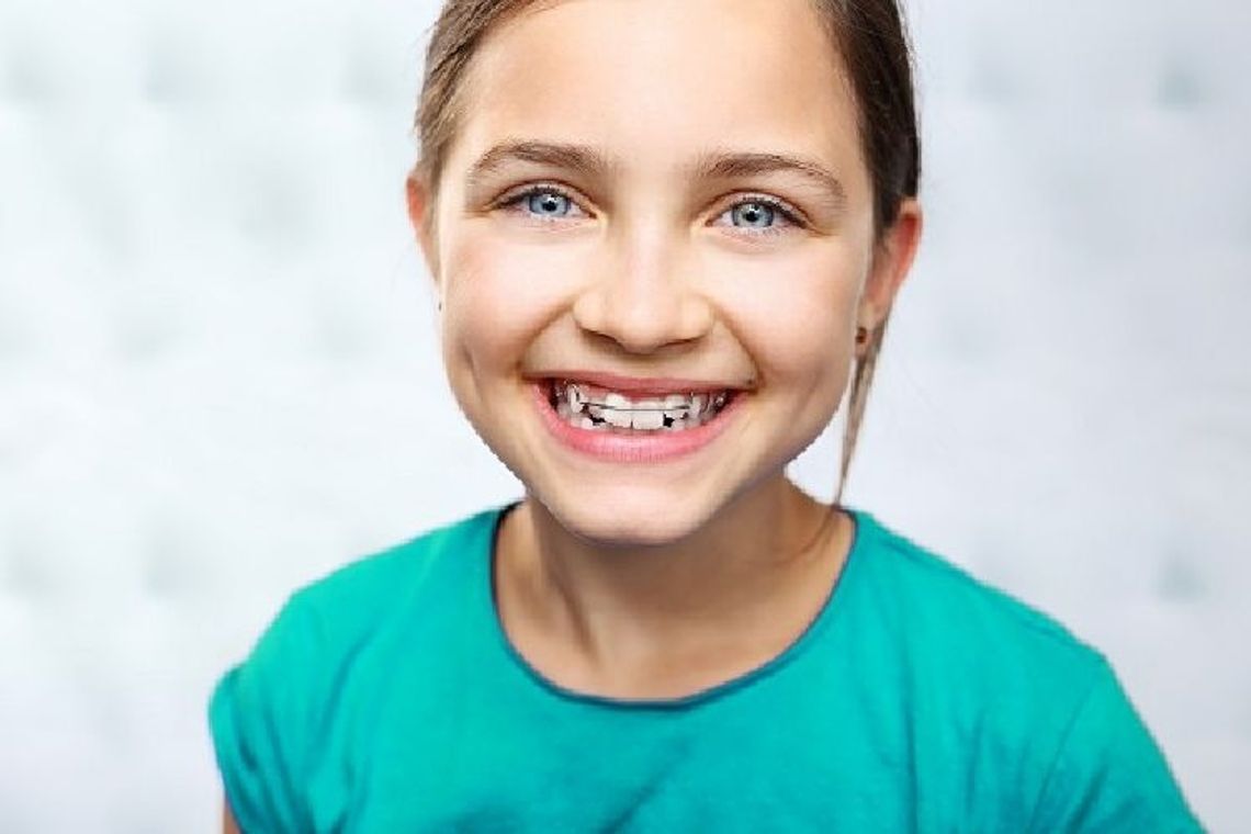 Ekspert radzi jak prawidłowo dbać o zęby z aparatem ortodontycznym