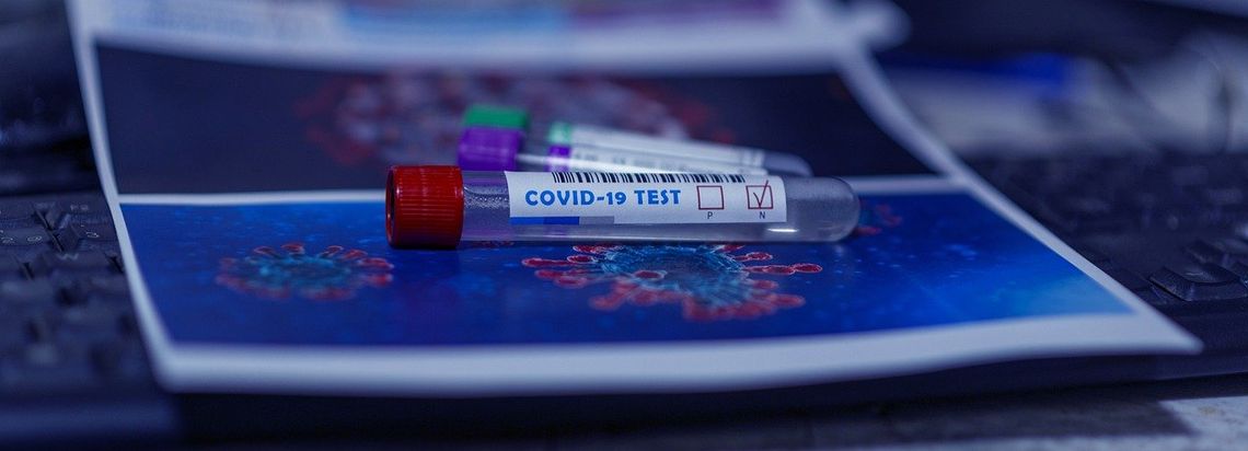 Kujawsko-pomorskie: Finansowanie testów na koronawirusa także dla POZ-ów